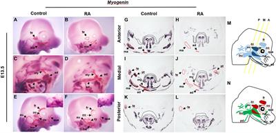 Branchiomeric Muscle Development Requires Proper Retinoic Acid Signaling